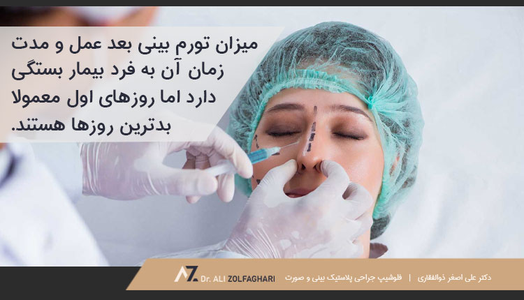 میزان ورم و تورم یک طرفه بینی بعد از عمل