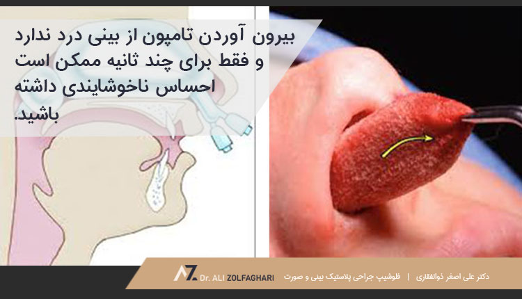 بیرون آوردن تامپون از بینی و احساس درد