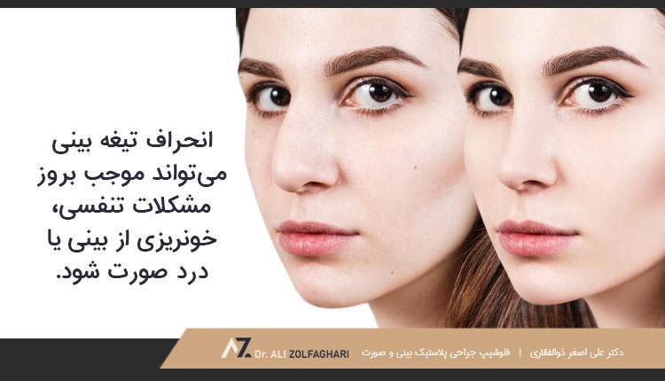تغییر شکل ظریف و بهبودی جریان هوا از طریق سوراخ‌های بینی برای عمل بینی طبیعی