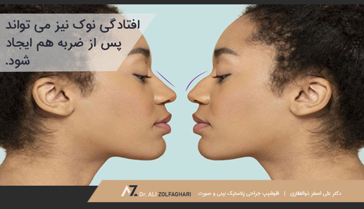 نوک بینی نامتقارن بعد عمل بینی