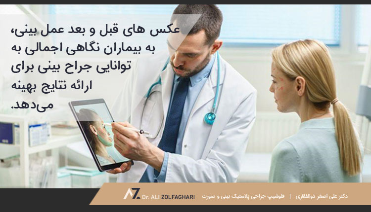 تاثیر عکس ‌های قبل و بعد عمل بینی بر انتخاب جراح