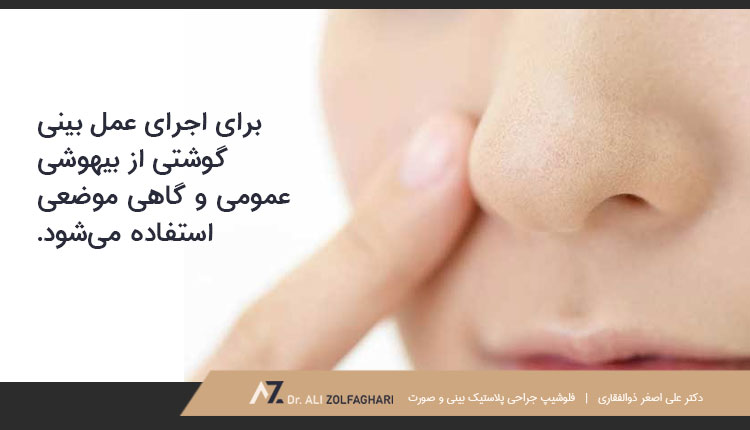 استفاده از بیهوشی عمومی برای عمل بینی گوشتی