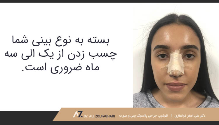 بسته به نوع بینی شما چسب زدن از یک الی سه ماه ضروری است.