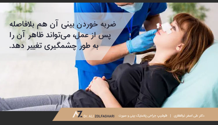 ضربه خوردن بینی بلافاصله پس از عمل