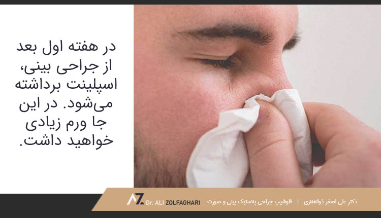 هفته اول بعد از جراحی بیتی