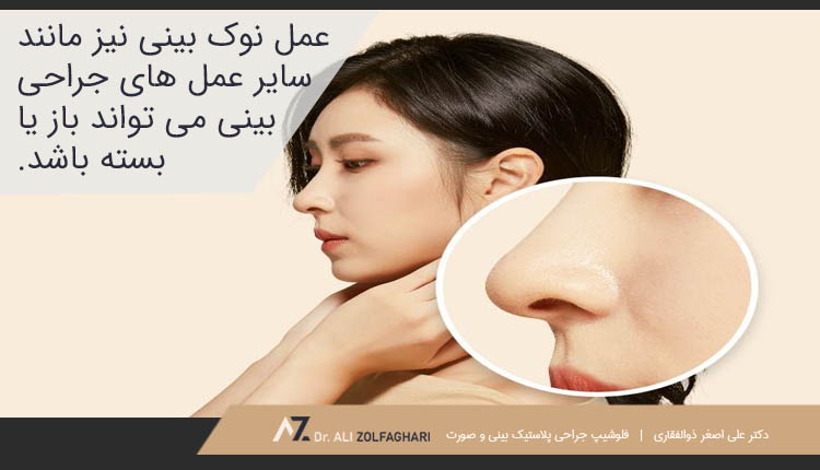 عمل نوک بینی با روش باز یا بسته انجام می شود
