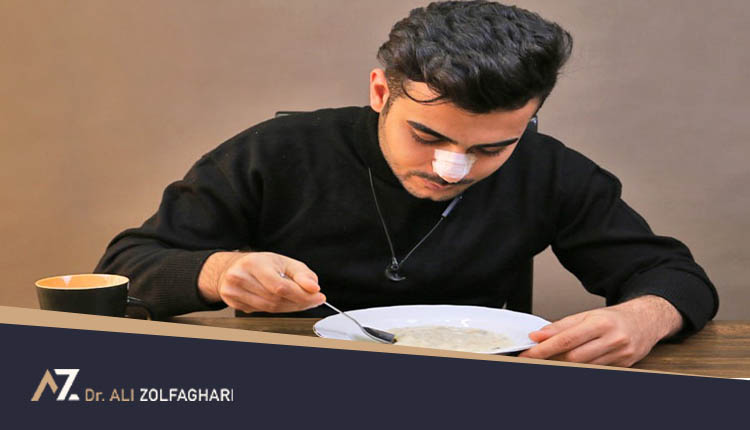 تغذیه و رژیم غذایی صحیح بعد از جراحی بینی