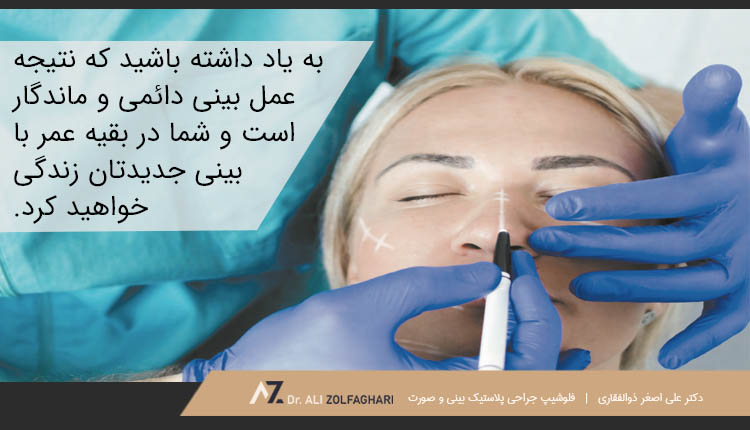نتیجه عمل بینی دائمی و ماندگار است