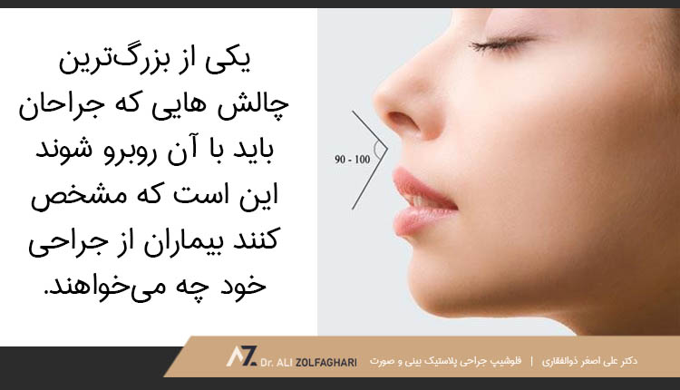 چالش های جراحان زیبایی بینی