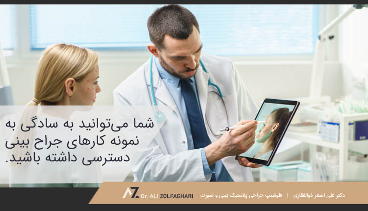 دسترسی به نمونه کارهای جراح بینی