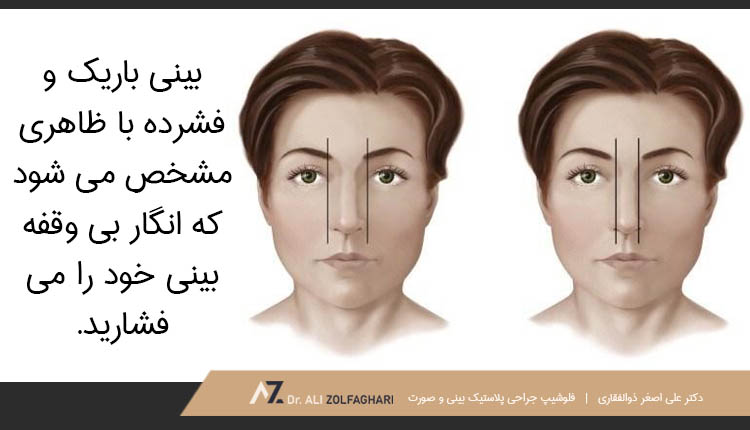 بینی باریک و فشرده با ظاهری مشخص می شود که انگار بی وقفه بینی خود را می فشارید.