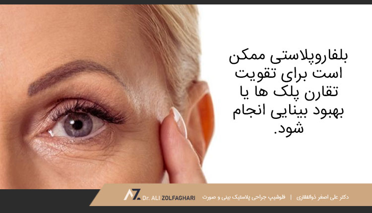 بلفاروپلاستی چیست؟