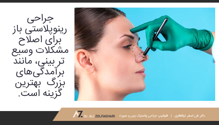 جراحی بینی باز چیست؟