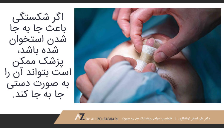 خود مراقبتی در زمان شکستگی خفیف بینی