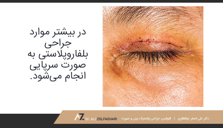 در حین جراحی بلفاروپلاستی چه اتفاقاتی می افتد؟