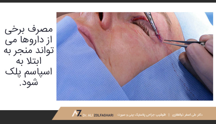 دلایل ابتلا به بلفارواسپاسم