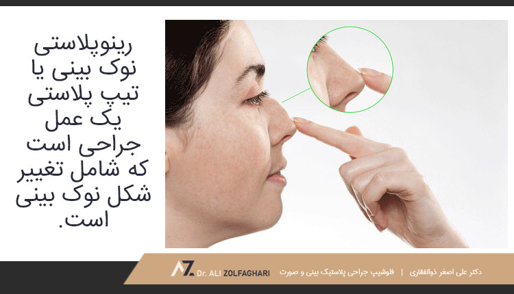  تیپ پلاستی چیست؟