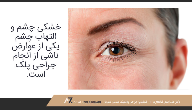 خشکی و التهاب چشم از دیگر عوارض جراحی پلک