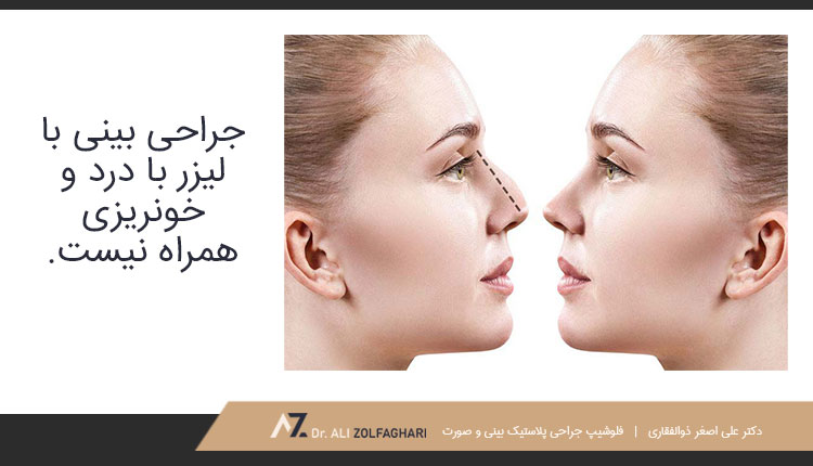 مراحل جراحی بینی با لیزر