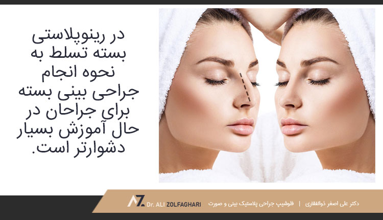 معایب جراحی بینی به روش بسته
