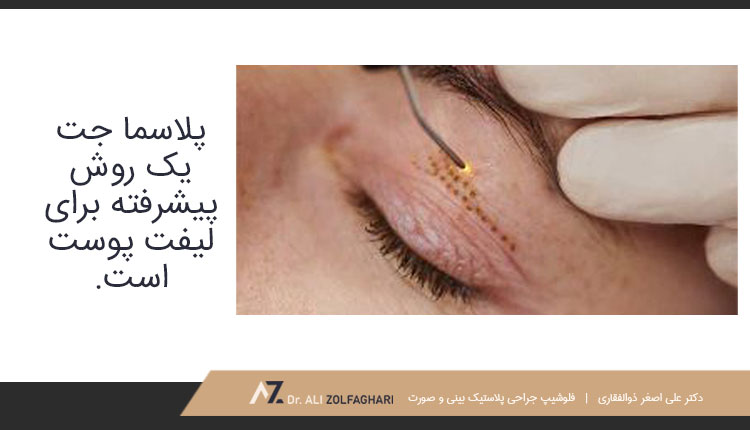 پلاسما جت چیست؟