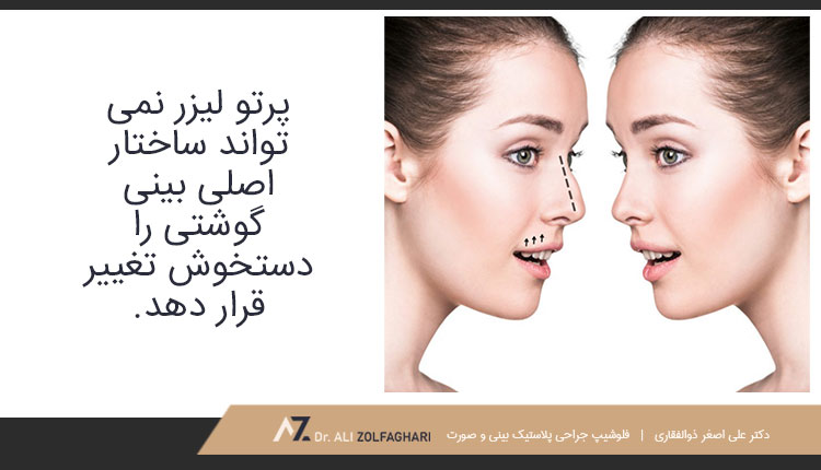 آیا بینی گوشتی با کمک لیزر کوچک می ‌شود؟