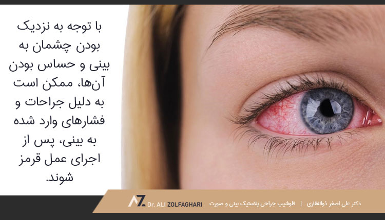 علت قرمزی چشم بعد از عمل بینی