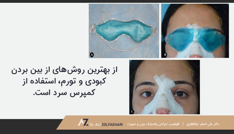 کمپرس سرد برای رفع کبودی چشم بعد از عمل بینی