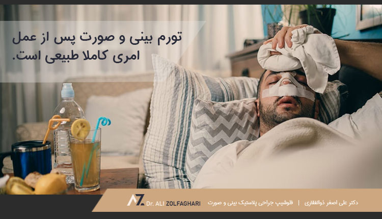 تورم صورت در دوران نقاهت عمل بینی
