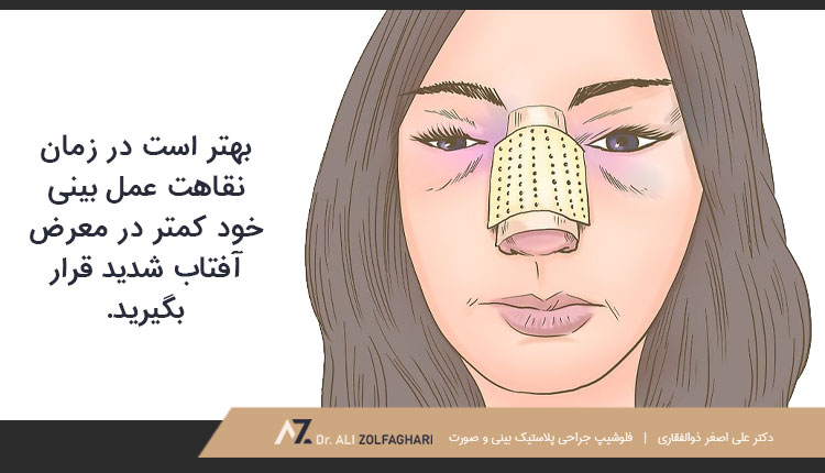 نکات مهم برای کاهش کبودی چشم بعد از عمل بینی