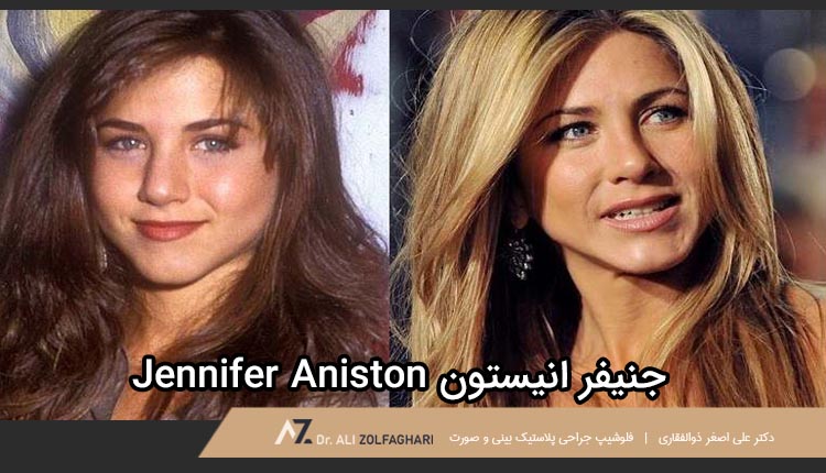 عمل بینی جنیفر انیستون