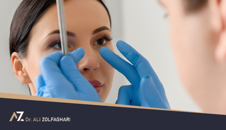 پیوند غضروف در عمل جراحی بینی | بررسی انواع و تفاوت غضروف ها