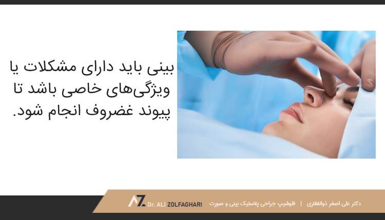 استفاده از بافت غضروف در بینی