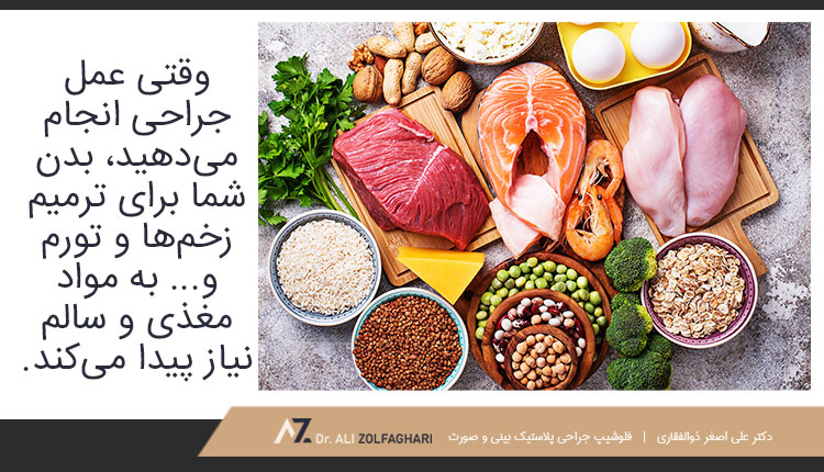 اثر تغذیه بر روند بهبودی بعد از عمل بلفاروپلاستی