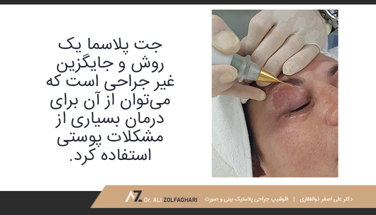از پلاسما جت برای انجام چه کارهایی استفاده می‌شود؟