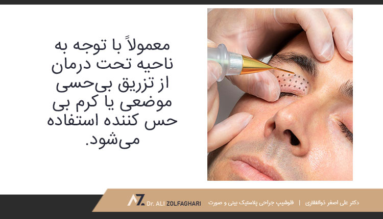 از پلاسما جت پلک چه زمانی استفاده می‌شود؟