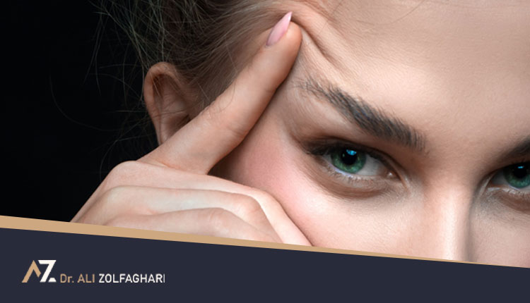 اصلاح افتادگی ابرو با جراحی