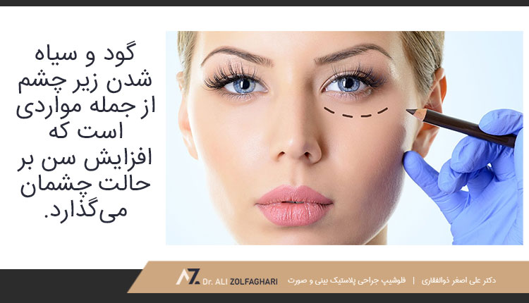 افزایش سن چه تاثیری بر حالت چشمان می‌گذارد؟