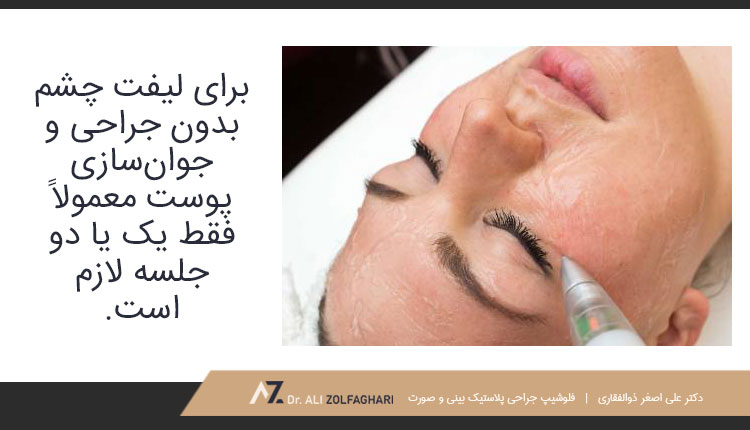 برای لیفت پلک با پلاسما جت چند جلسه لازم است؟