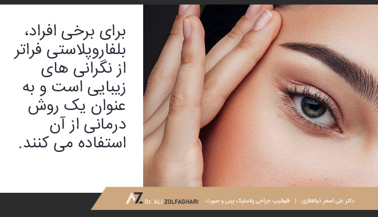 بلفاروپلاستی نیز به عنوان یک روش درمانی استفاده می شود