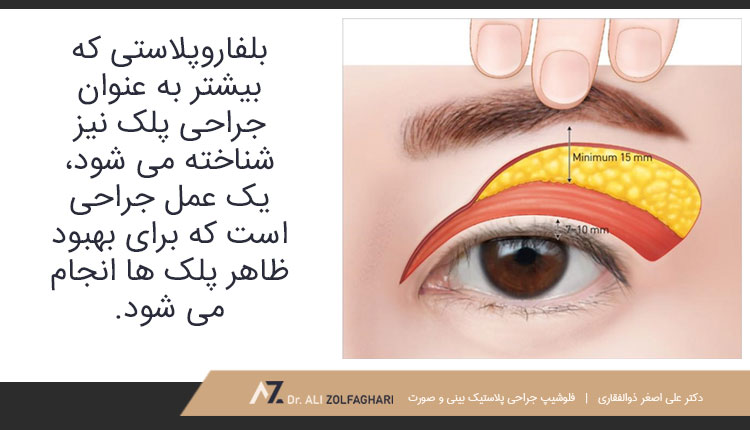 بلفاروپلاستی