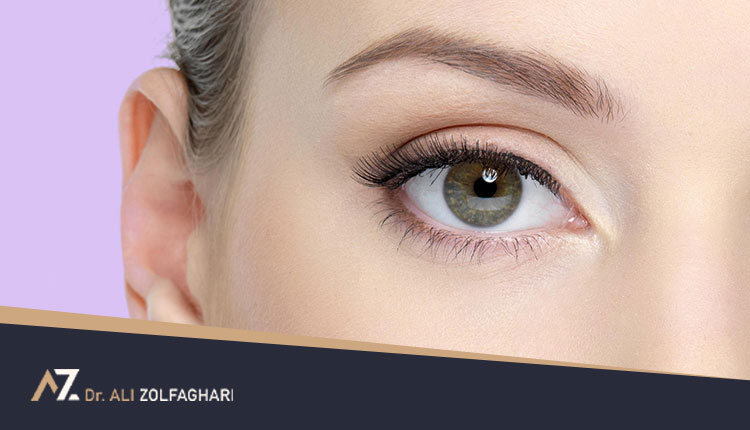 بهترین سن برای عمل بلفاروپلاستی چه زمانی است؟