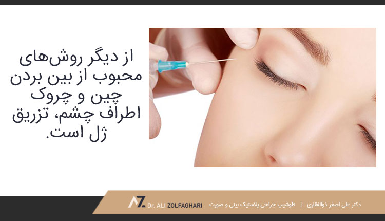 تزریق ژل برای ازبین بردن چین و چروک اطراف چشم