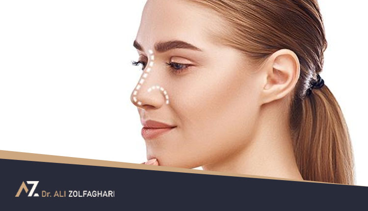 تفاوت عمل جراحی باز و بسته بینی چیست؟