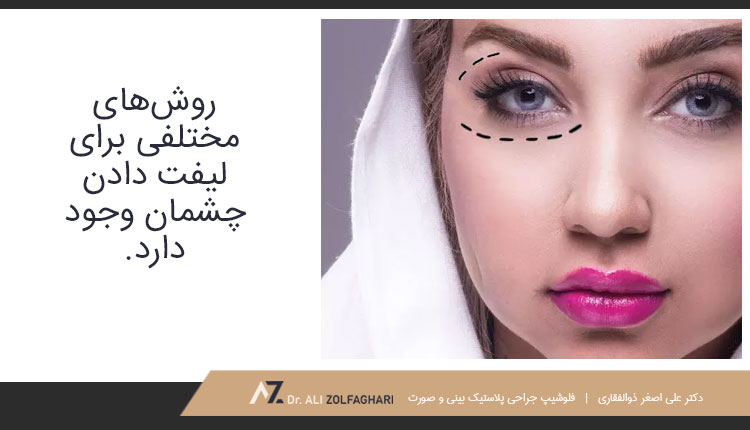 روش‌های مختلف لیفت چشم