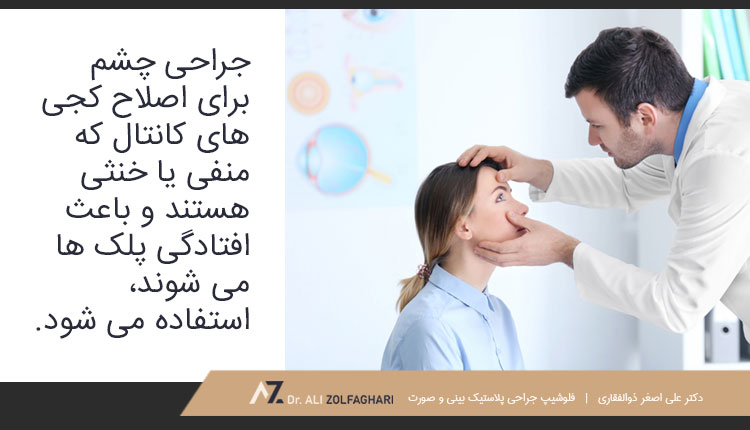 جراحی چشم برای اصلاح کجی های کانتال