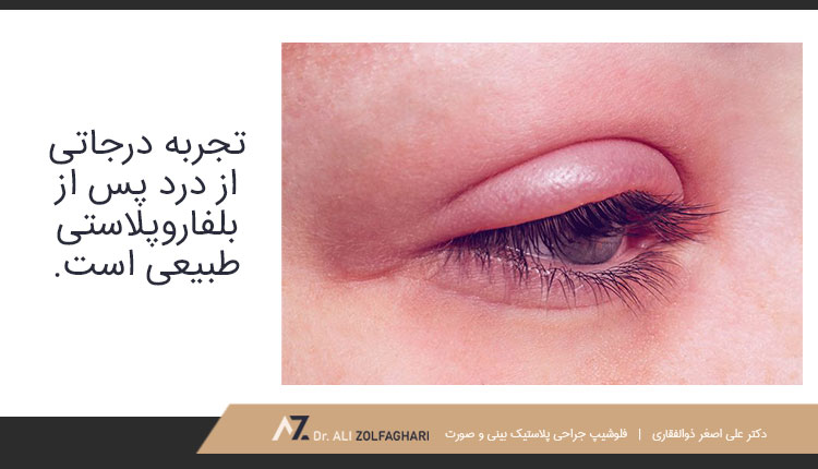 عمل بلفاروپلاستی چیست؟