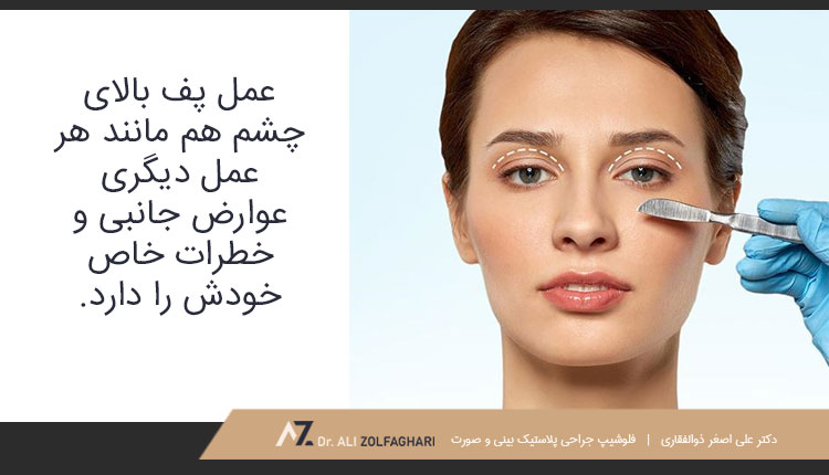 معایب عمل پف بالای چشم