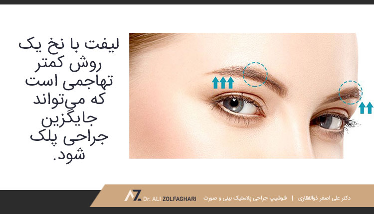لیفت چشم با نخ