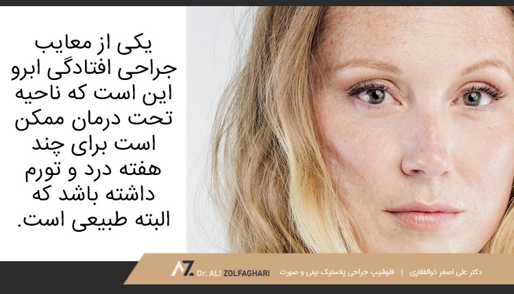 معایب جراحی افتادگی ابرو